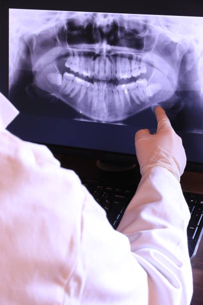Best Emergency Root Canal Treatment in Dunstan, ME