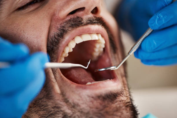 Best Emergency Broken Tooth Repair in Dunstan, ME